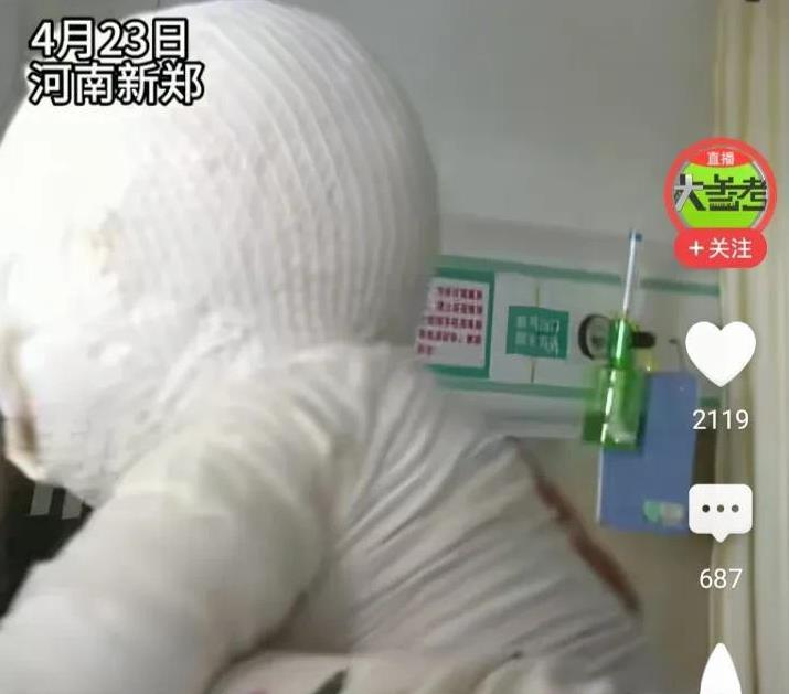 太可怜了，如果这位妈妈炸好把鸡块捞出来，不端什么油锅，让油锅就在灶上放凉就好了。