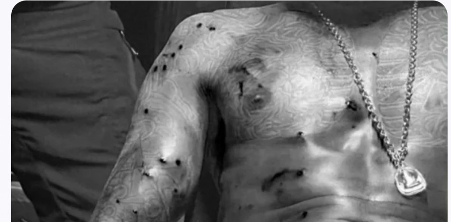 东南亚枪击案件：泰国街头惊现中弹20枪，浑身如筛子，还能来去自如的壮汉！


