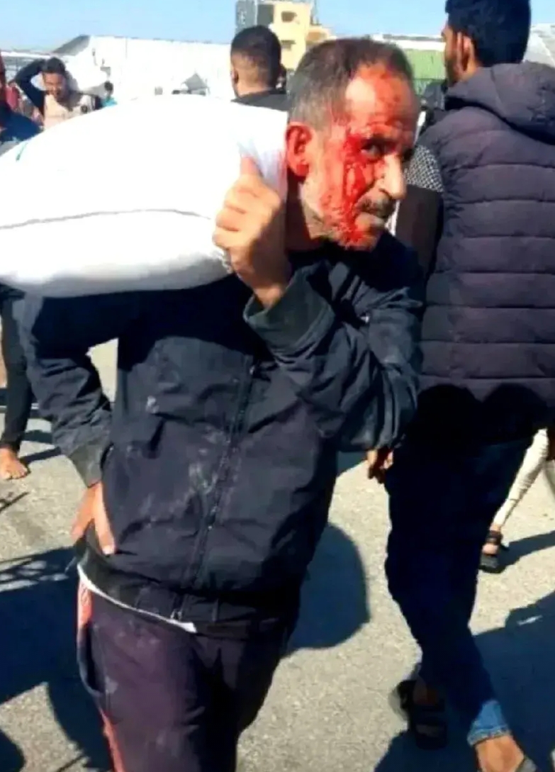 加沙平民只为抢一袋面粉，头破血流成了家常便饭，饥饿到底有多么可怕，没有经历过的人