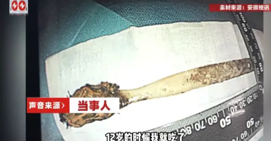 “真是命大！”安徽滁州，64岁老人时常感觉胸口不舒服，有时发闷喘不上来气，有时疼