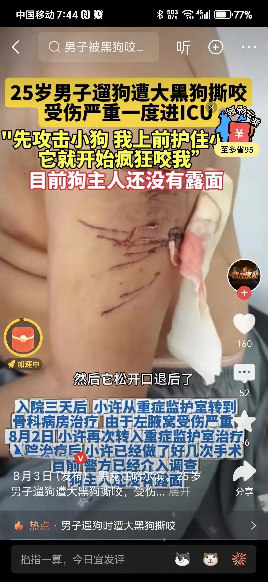 25岁男子遭大黑狗撕咬，受伤严重住进ICU。
这狗必须得管管了，无绳狗，流浪狗必