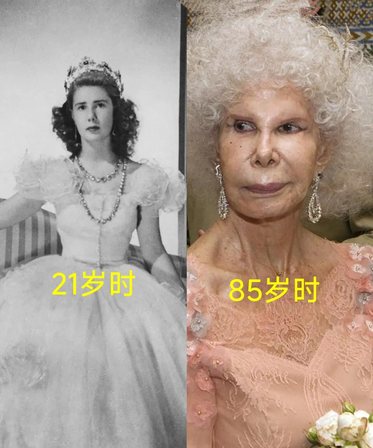 晚年时的这位公爵夫人经常会顶着一头白发和整形的脸，时不时就会成为板鸭当地的娱乐内