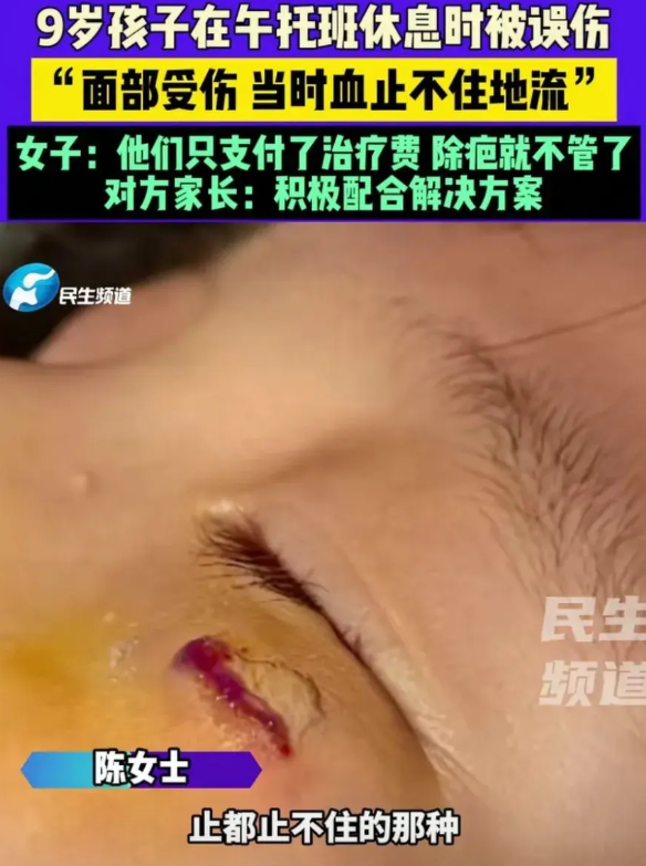 两个学生在托管里玩闹，玩具飞出去刮伤了一个男孩的眼睛，托管老师赶紧把受伤的男孩送