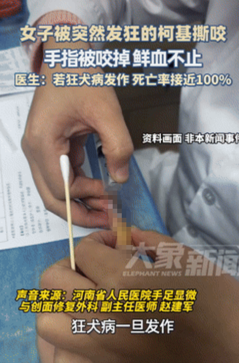 太悲催了！河南郑州，一女生给宠物狗洗澡时，竟遭到它疯狂啃咬，直到将手指给咬掉才肯