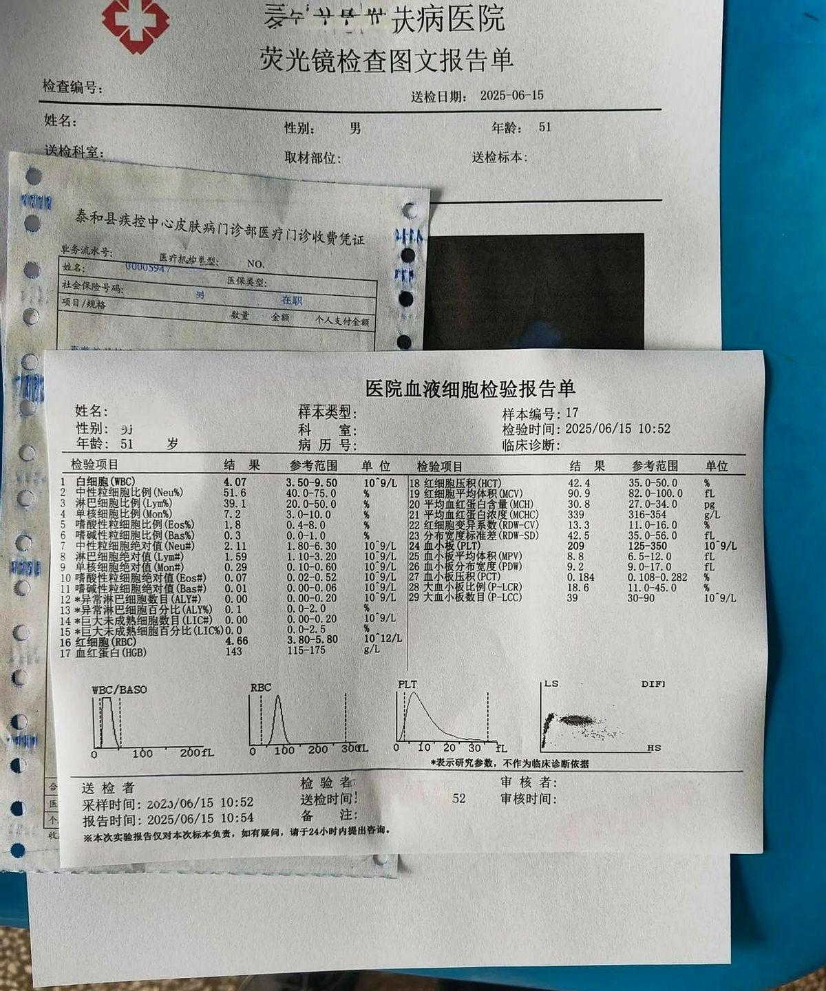右大脚趾甲好像染到了灰指甲，今天到皮肤病医院看了看，药品费17块多钱，检测费倒是