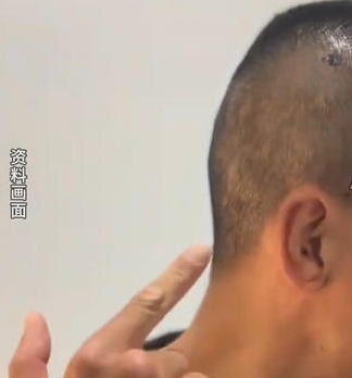 拳手周润琪在澳遇袭受伤昏迷，金腰带周润琪遇袭凶手被抓获

10月16日，职业拳击