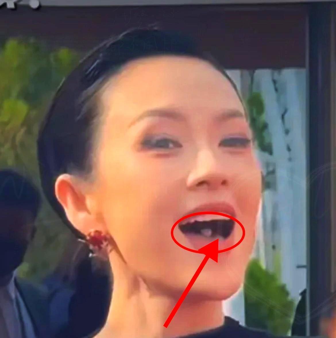 娱乐圈化妆师爆料女明星私下真实状态。
原来很多女星都有口臭问题。
长期节食导致肠