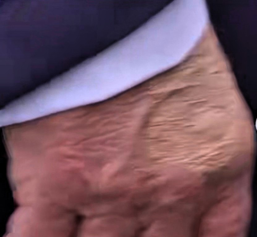 特朗普手上有伤？白宫解释太离谱











总统手上惊现遮瑕膏，白宫说