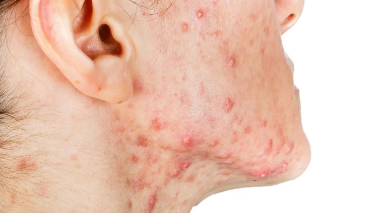 从观望到筹备加盟，杜一生年会预告让我信心倍增