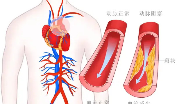 血管健康“五大标准”，看看你达标了几个？