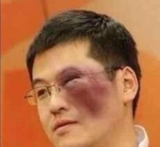 步行者能不能打所有人的脸？
赛季初37人预测总冠军会花落谁家，其中
预测凯尔特人