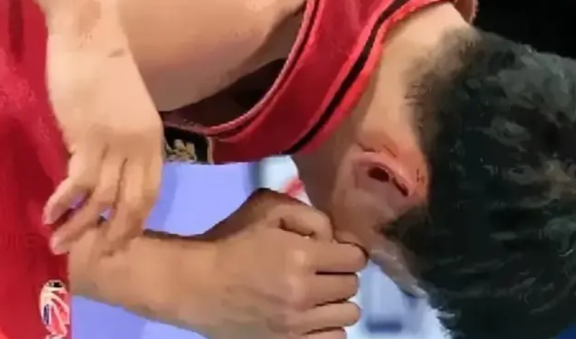 周琦受伤，竟还有人说风凉话，这良心不会痛吗？
周琦受伤后，总有人怪他体质差。可谁