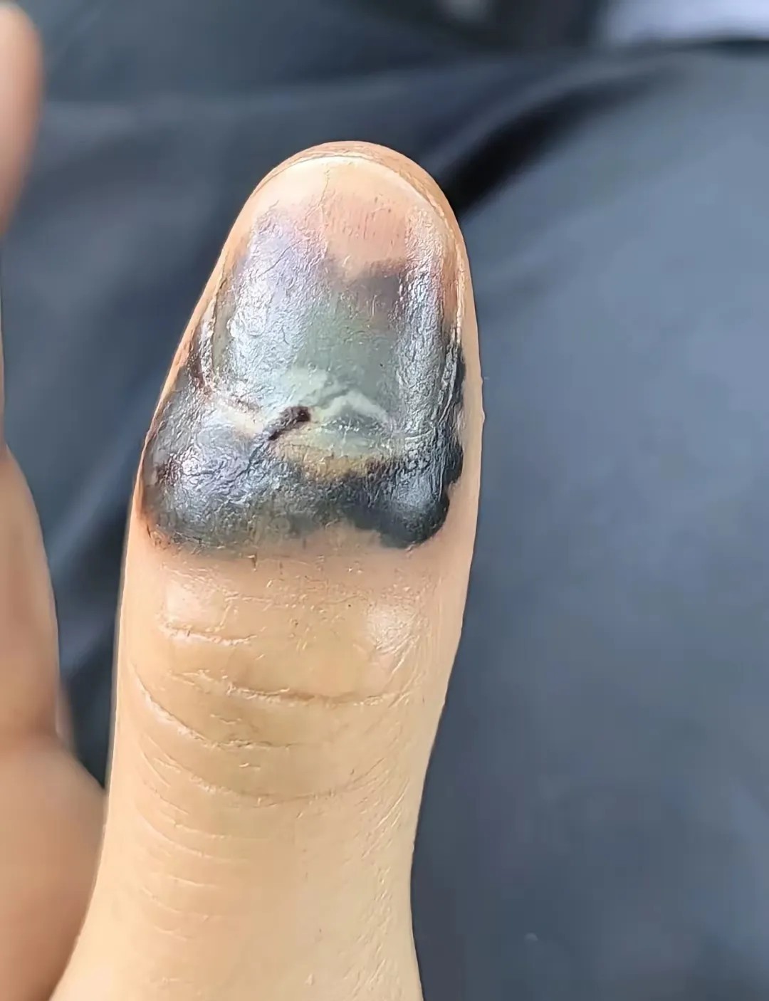 这手指上医院还有救吗？