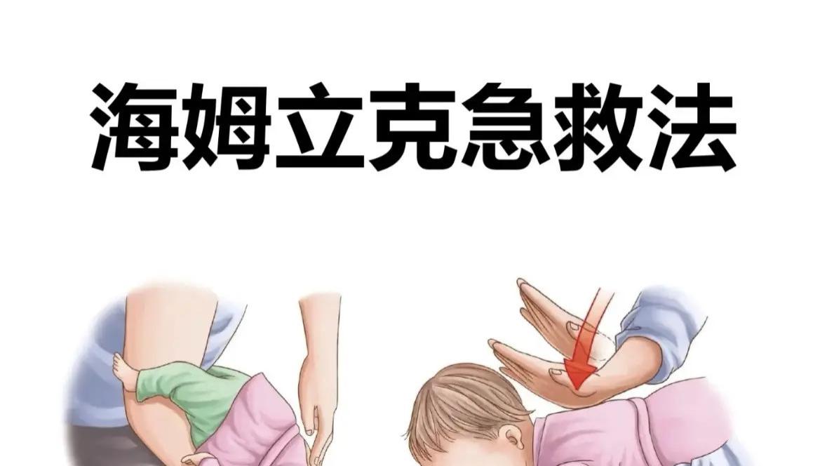 卡喉急救指南：家长必学的“黄金4分钟”保命术