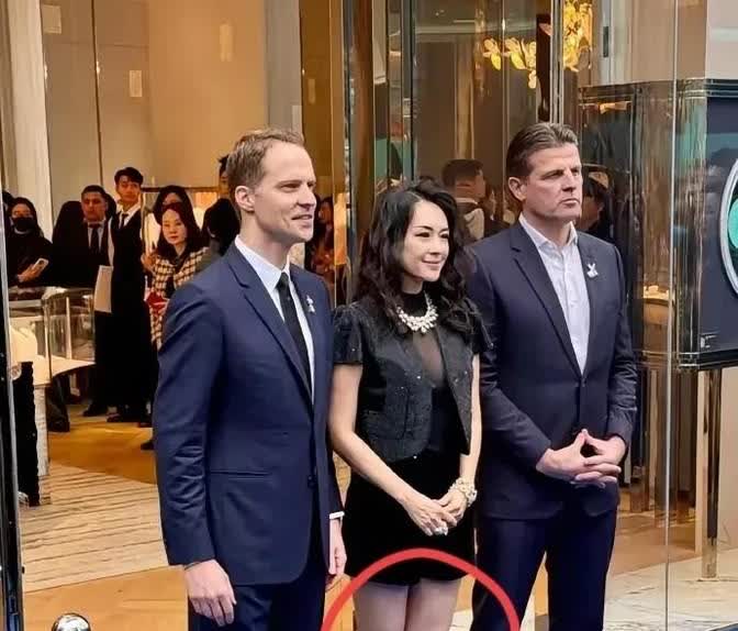 看到章子怡的腿现在这样，真是让人吓一跳。

这到底是怎么回事呢？
是因为太
