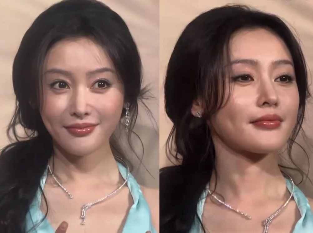 苹果肌千万别乱填啊！
张天爱你究竟对自己美丽的脸做了什么！
都把自己整成叶珂2.