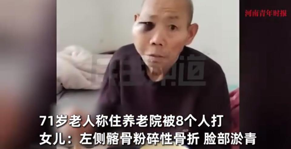 河南一女子把71岁老父亲送进养老院，一段时间后被养老院告知她父亲摔到了腿。女子赶