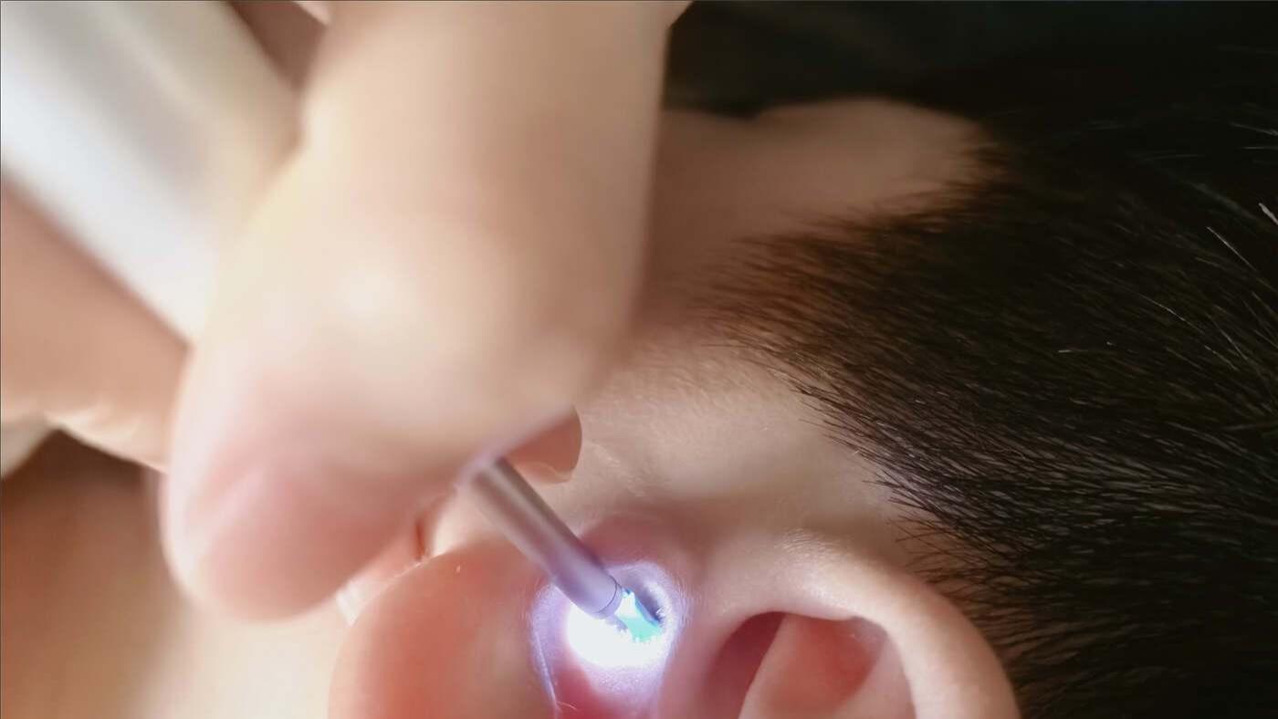 宝宝里的耳屎怎么清理？目前最推荐的十款宝宝挖耳勺