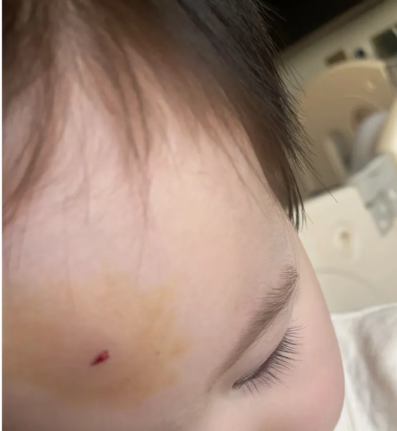 我把大姑姐打进了医院……
起因是我大姑姐女儿要抢我闺女的玩具，我闺女不让，她女儿