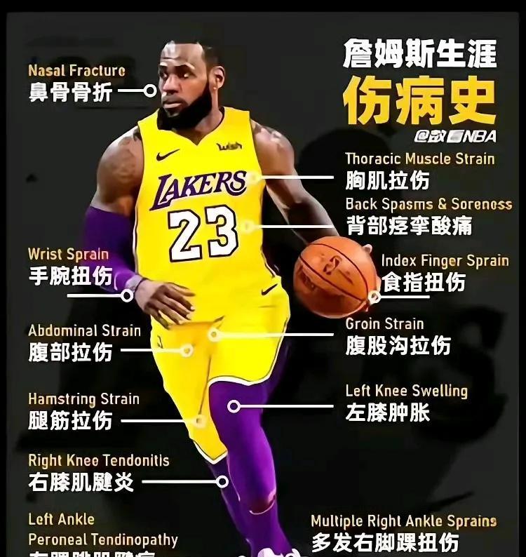 詹姆斯职业生涯伤病史，真铁人至今没重伤！
很多球员被伤病困扰，这方面詹姆斯还好。