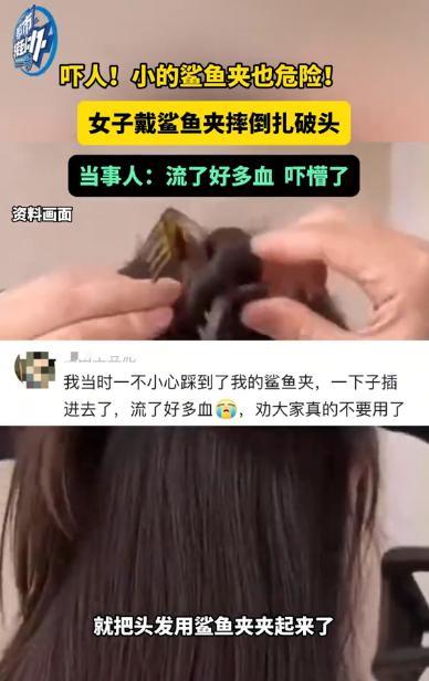 “谁还敢乱带发夹！”近日，河南一女子过生日为了拍照，便用鲨鱼夹把头发夹了起来，结