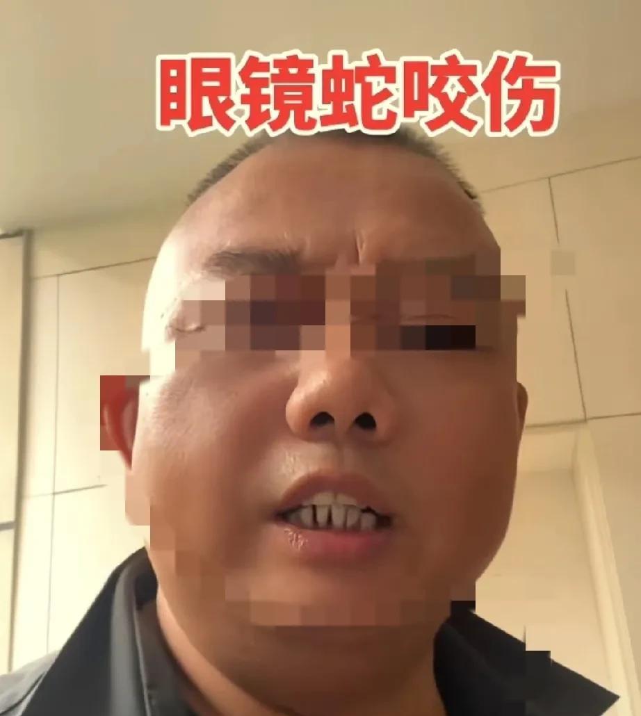 三亚被蛇咬女子走，一个教阿宝博主火了。
1、撕裂伤，无毒蛇
2、有两个窟窿眼的，
