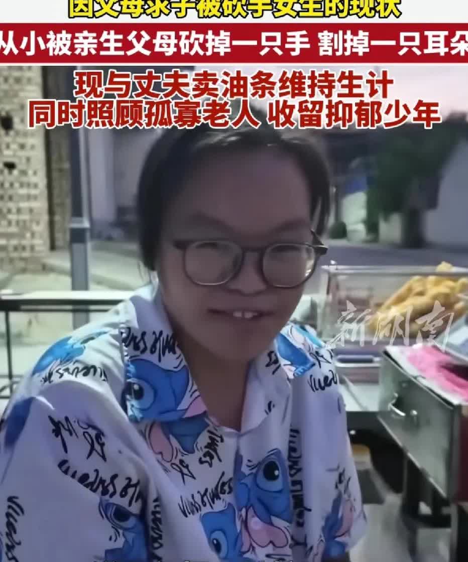 假的吗？女子自述：父母想要儿子，听信了算命的话，便对自己砍手割耳。
女子所居住
