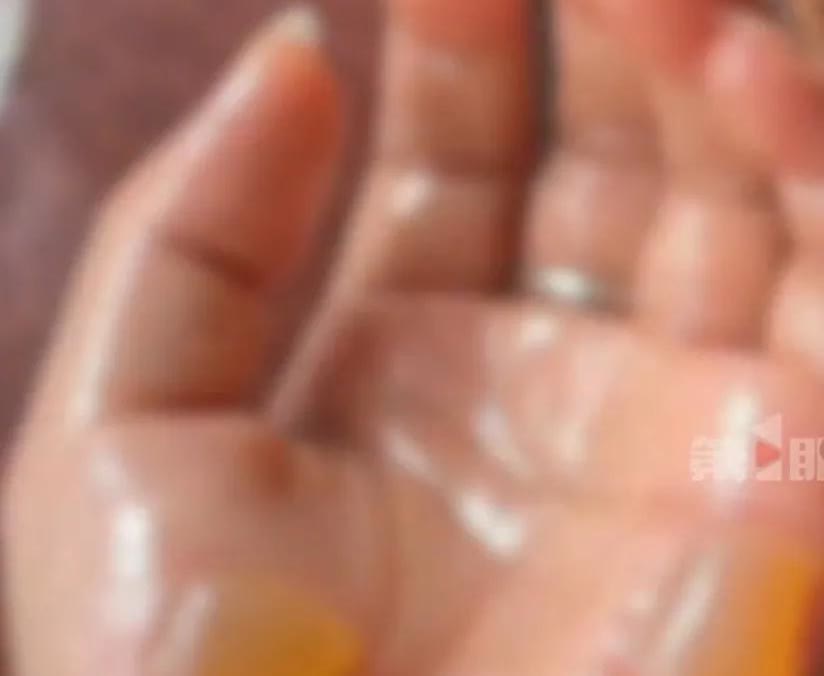 高压锅煮绿豆意外爆炸，厨房一片狼藉，女子身上多处被烫伤！