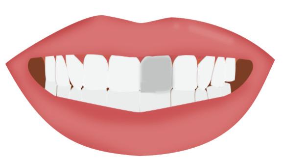 警惕！牙齿从剧痛到不痛，可能不是自愈，而是……