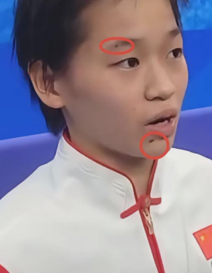 许多人都注意到全红婵下巴的痦子，
其实，她眉间也有一颗！而且，这并非偶然！
