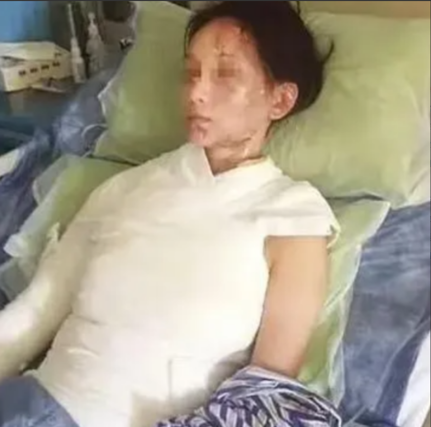 2015年8月，浙江一女子吃火锅让服务员加汤，因顾客多，服务员5分钟后才到。女子