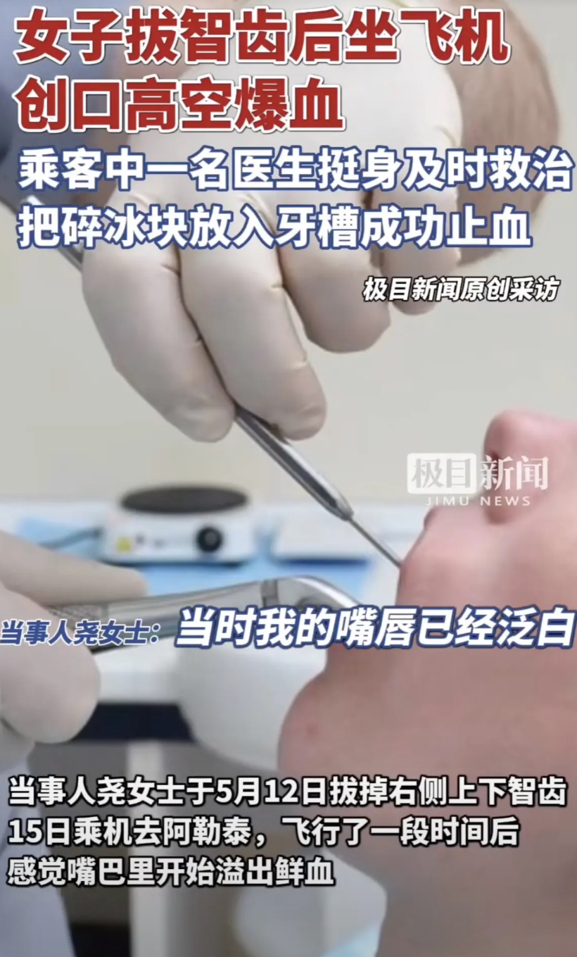 “怪不得飞行员不能有伤疤！”5月15日，一女子拔完智齿坐飞机，岂料伤口在高空中突