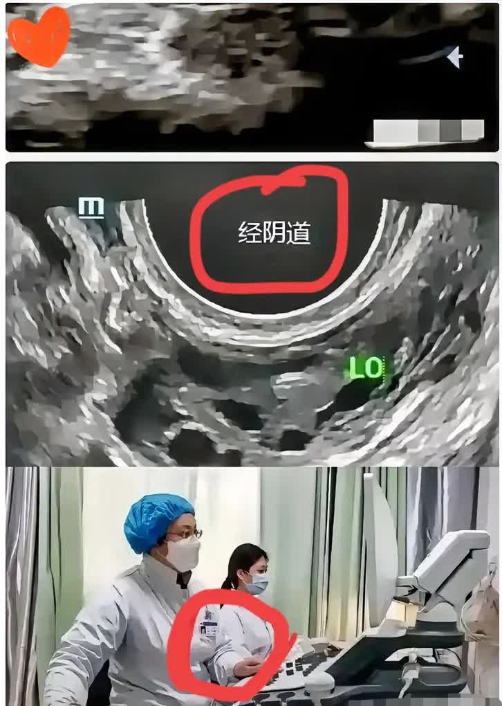 见过离谱的，没见过这么离谱的！苏州姑娘王女士去苏州市立医院东区做腹部B超，结果被
