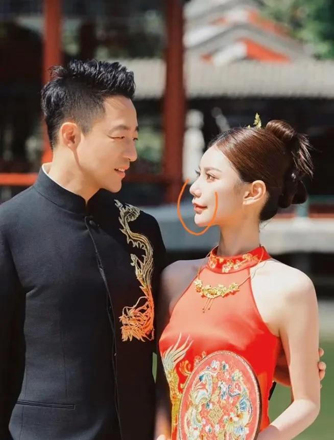 汪小菲马筱梅婚礼对视瞬间被定格。
仔细看马筱梅，说实话，发现她也不是多漂亮，脸上