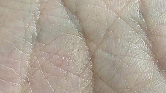 【揭秘断掌】有人说“男儿断掌千斤两”，真相竟然是这样！