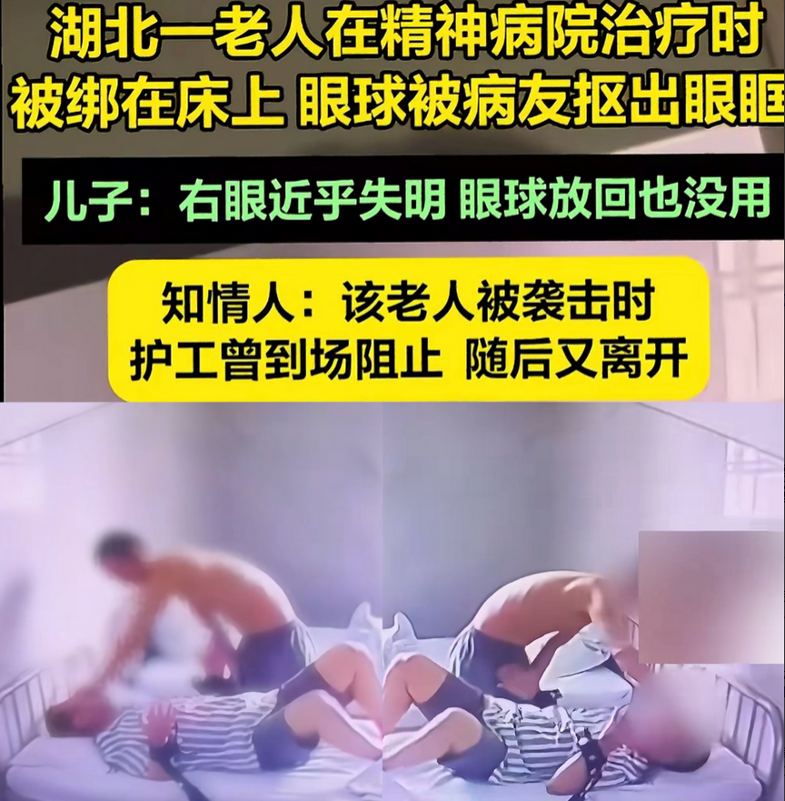 恐怖，湖北黄石一精神病院，一名精神病患者突然袭击另一名双手被捆的患者王某某，残忍