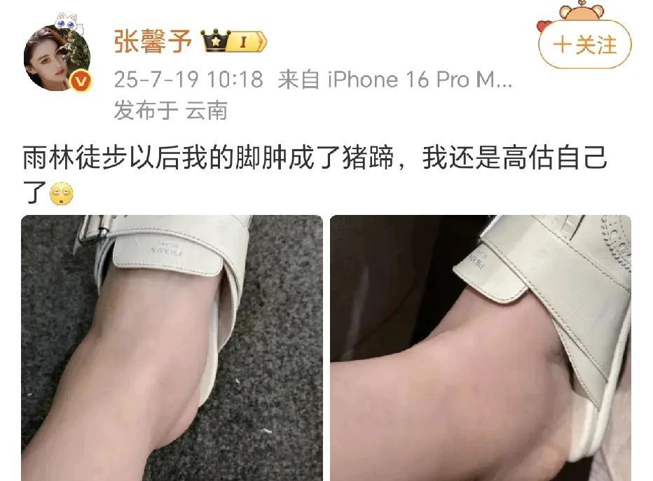 张馨予脚肿成猪蹄！
张馨予和老公一起走进了大自然，她的胆子是真的大。毛毛虫直接抓