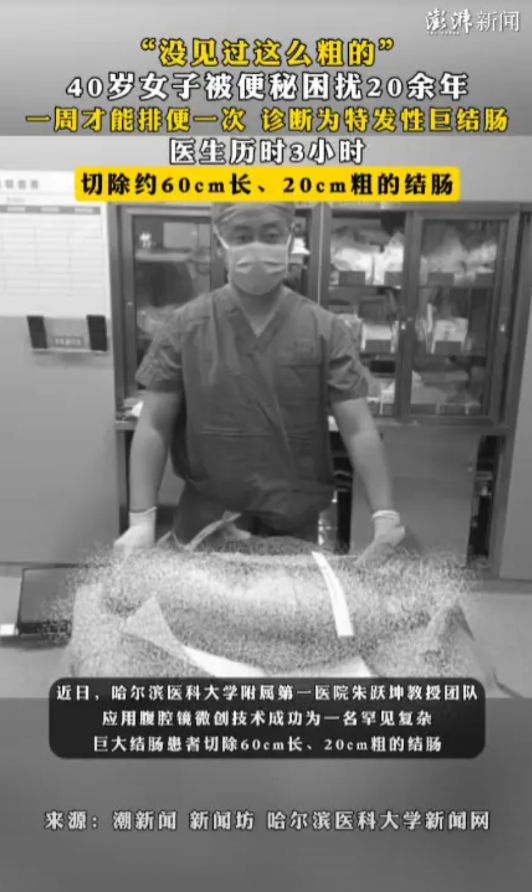 “活久见！”近日，黑龙江哈尔滨，一位40岁的女子被便秘困扰20多年，最终被医生用