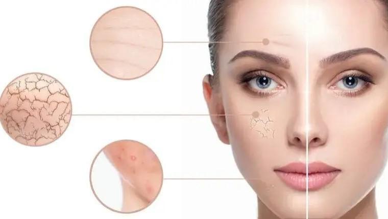 2025干皮敏感肌面膜大测评，面膜哪个牌子温和补水保湿效果好