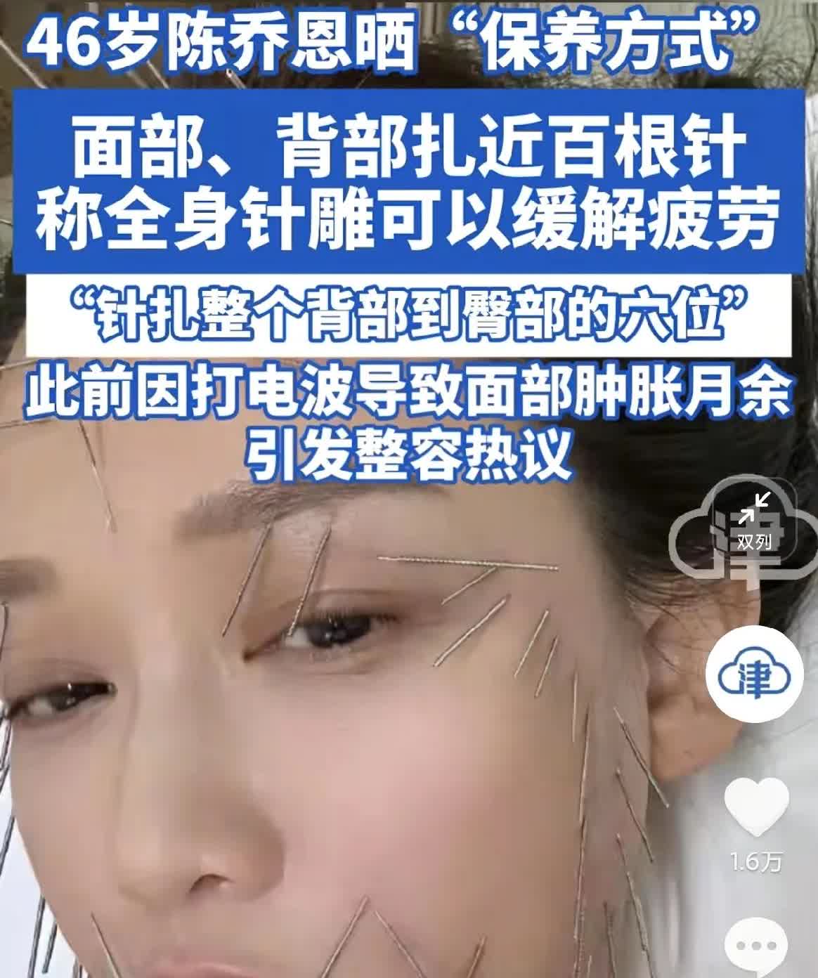 现在女明星终于说实话了，
不是靠敷面膜维持美貌了，而是千针万孔。
46岁的陈