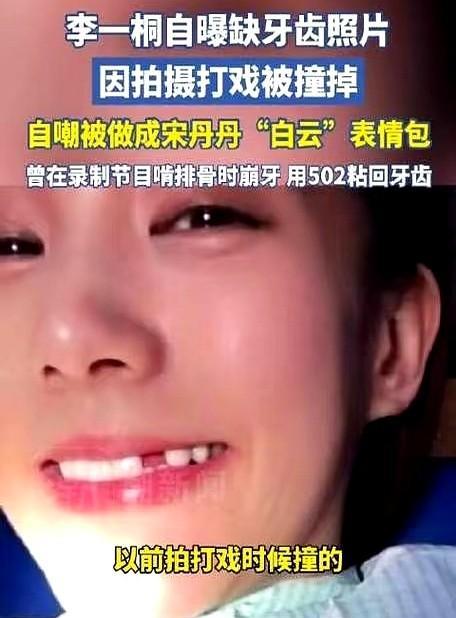 缺牙=毁容？李一桐的牙缝照吓到你没？
镜头前她笑得甜，镜头后她捂嘴躲。
李一桐拍