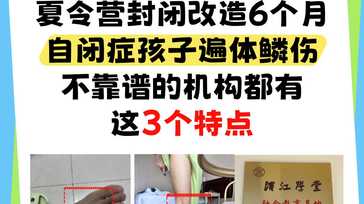 夏令营封闭改造6个月，自闭症孩子遍体鳞伤，不靠谱的机构都有这3个特点