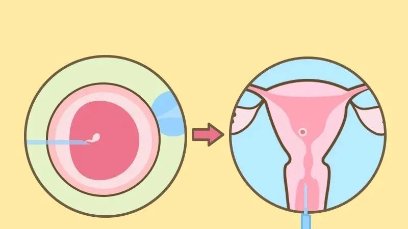 试管婴儿冻胚移植成功率高不高?