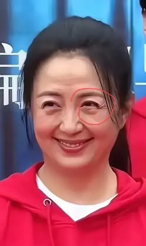 我看了杨童舒50岁了长相的照片，做出了以下三个决定：第一个决定，放弃整大眼睛了，