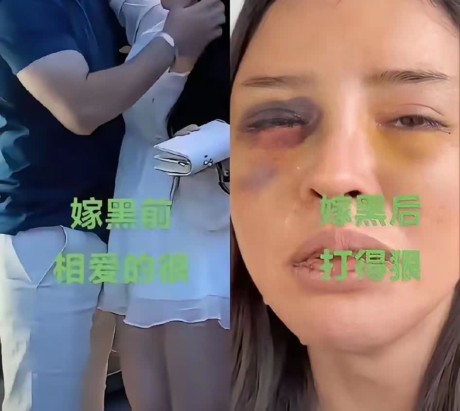 一名女子不听家人劝阻，死活要嫁给黑人！

如今，“回旋镖”打到了自己身上，在