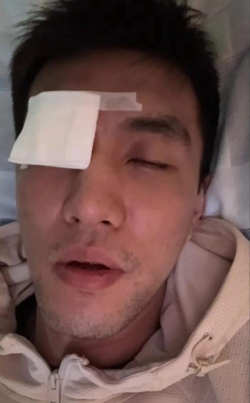 郭艾伦被队友戳伤眼睛之后，心态真的崩了，艾伦直言要是瞎了就不活了！

对于队友的