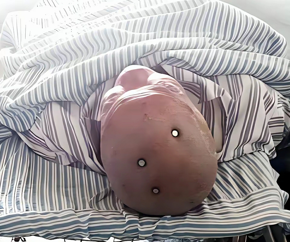 我的天呐 这三个钉子怎么扎进去的呀 看着好疼啊