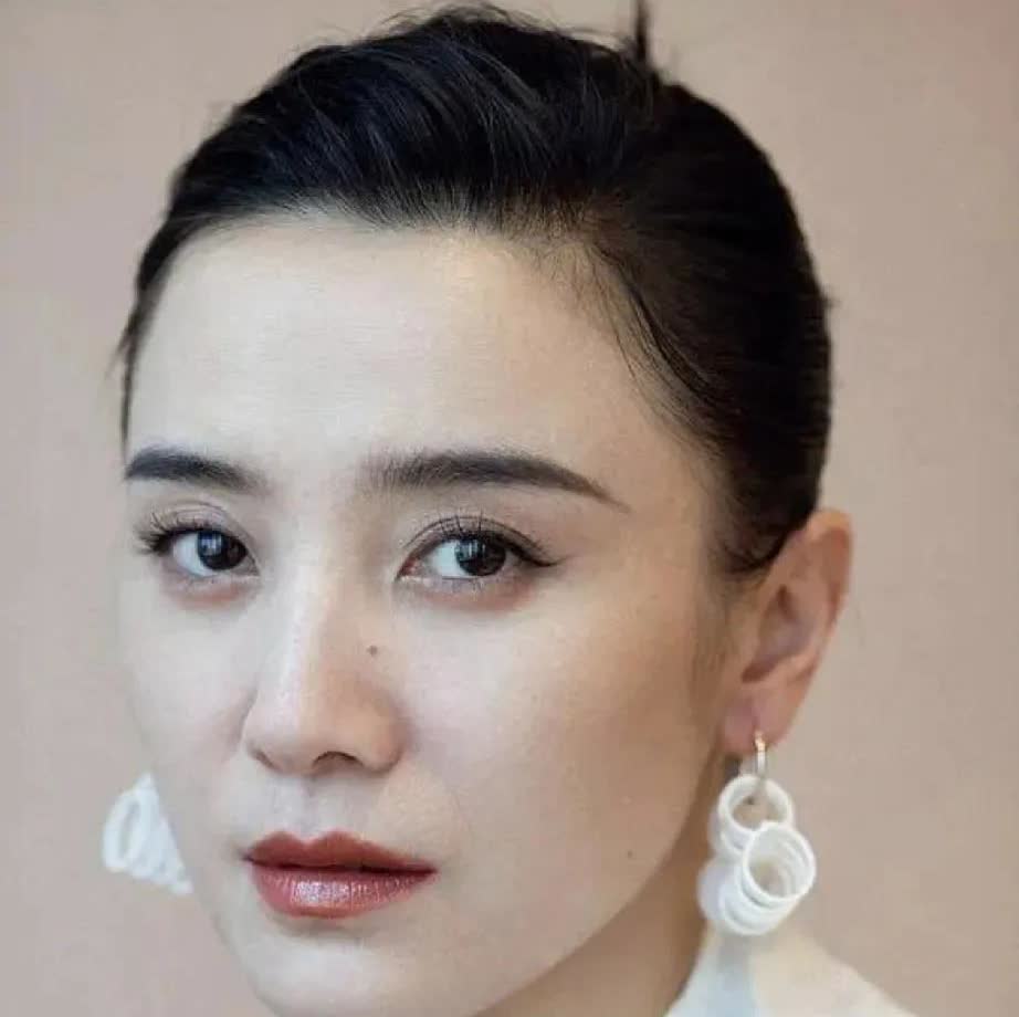 孙俪把痣点掉了，我脸颊上有个cuo子，要不要点掉啊？这脸上的痣真的影响名运吗？
