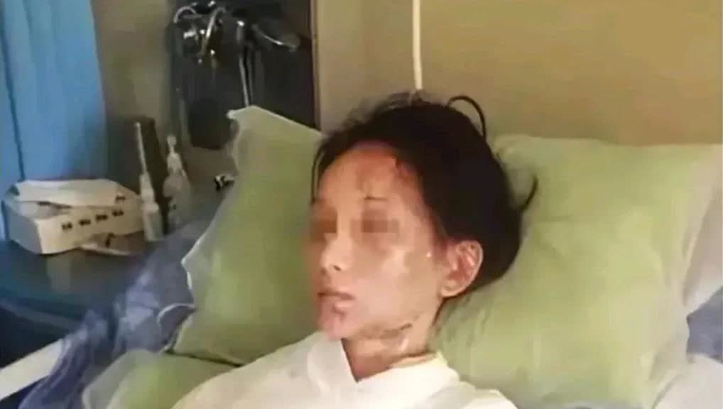 “这是嘴欠的下场，变成这揍性！”2015年，浙江一女子吃火锅时喊服务员加汤，因顾