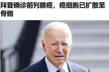 老白得癌晚期 扩散到骨头了











嘿，你敢信？老白竟然得了前列腺
